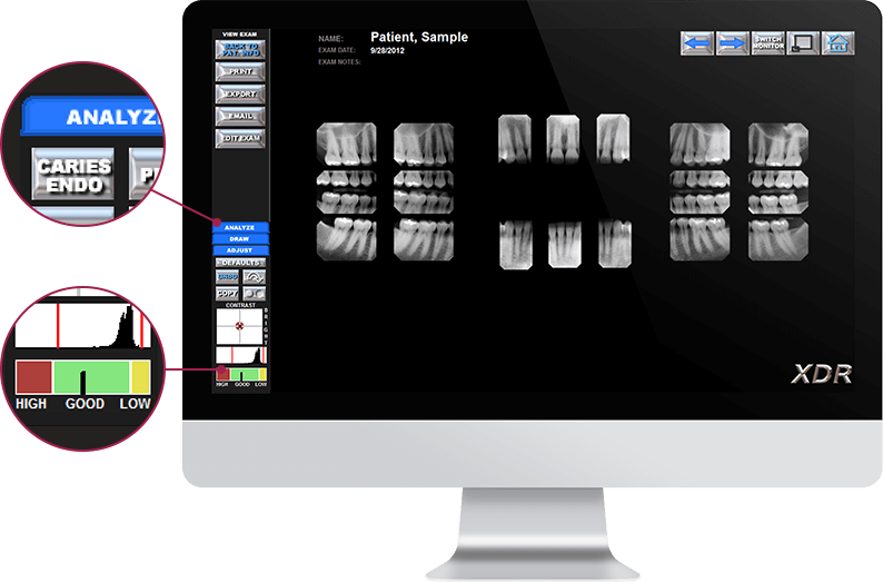 screenshot of XDR Dental Imaging